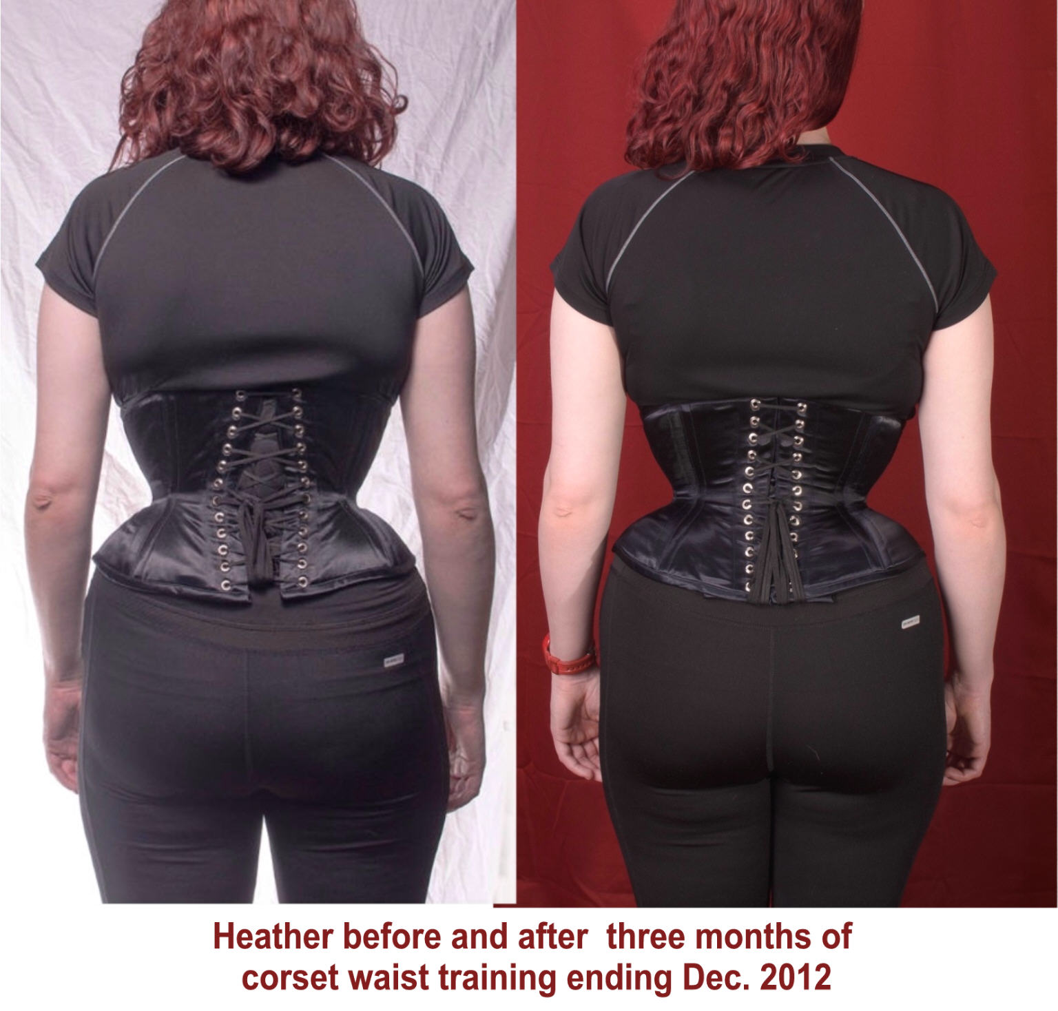 The Corset Diet” — and other troubling approaches to figure reshaping